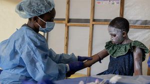 Mpox Vaccine Delays Challenge Africa's Health Response