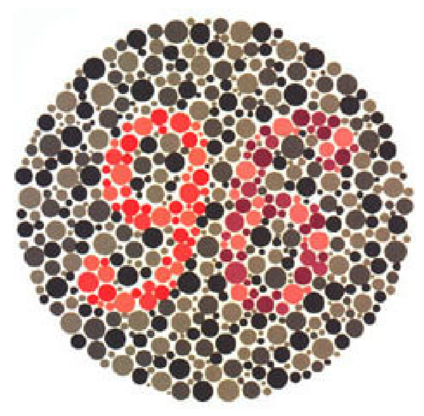 Plaka 25: Normal görüşlüler 96 görürler; kırmızı renk körleri (protanopya) veya kırmızı renk görüşü zayıflığı olanlar (protanomali) 6 görürler; kırmızı-yeşil renk körleri (deuteranopya) veya kırmızı-yeşil renk görüşü zayıflığı olanlar (deuteranomali) 9 görürler.