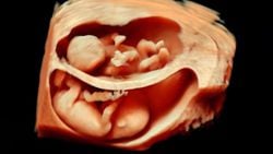 Bir Bebeğin 3 Boyutlu ve 4 Boyutlu Ultrason Görüntülerini Almak Mümkün ve Bu, Sigaranın Bebekler Üzerindeki Zararlarını Gösteriyor!