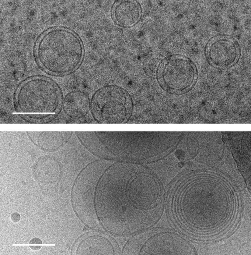Transmisyon elektron kriyomikroskopisi kullanılarak alınan, daire şeklinde gözlenen hücre zarlarının fotoğrafları. Üstteki görsel: solüsyondaki aminoasit bulundurmayan hücre zarları. Alttaki görsel: Hücre zarlarını, çoklu eşmerkezli zar tabakalarını oluşturmak üzere tetikleyen bir aminoasit olan serini içeren solüsyondaki hücre zarları. (Ölçek çubukları: 100 nanometre)