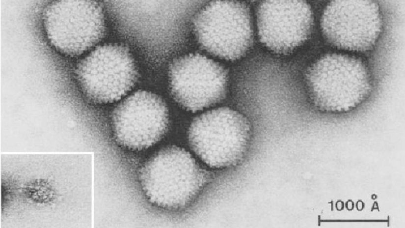 Human adenovirus 36 (HAdV-36)