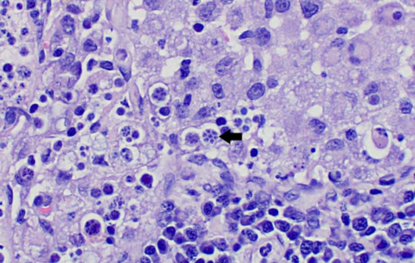 Bir köpeğin lenf nodlarından elde edilmiş histolojik kesitte Prototheca wickerhamii'nin mikroskoptaki görüntüsü. Bu tipik parçalı yapının sebebi endosporulasyon adı verilen eşeysiz üreme tipi sonucu oluşan yeni soyların tek bir hücre içinde konumlanmasıdır.