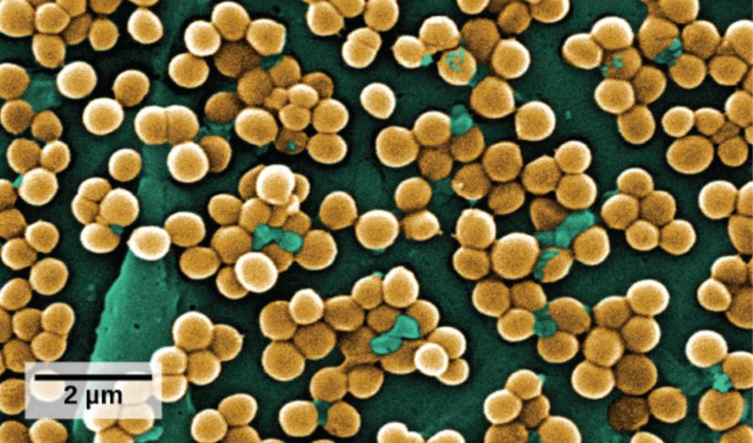 Elektron mikroskobu altında metisilin dirençli Staphylococcus aureus bakterisi.