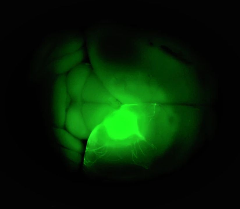 Image du cerveau de souris d'un organoïde humain transplanté (vert clair) pour étudier le comportement des neurones dans le contexte de la santé et de la maladie