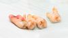 Otojen Diş Transplantasyonu (Ototransplantasyon) Nedir? Körelmiş 20 Yaş Dişlerini, Avantaja Çevirmek Mümkün Olabilir!