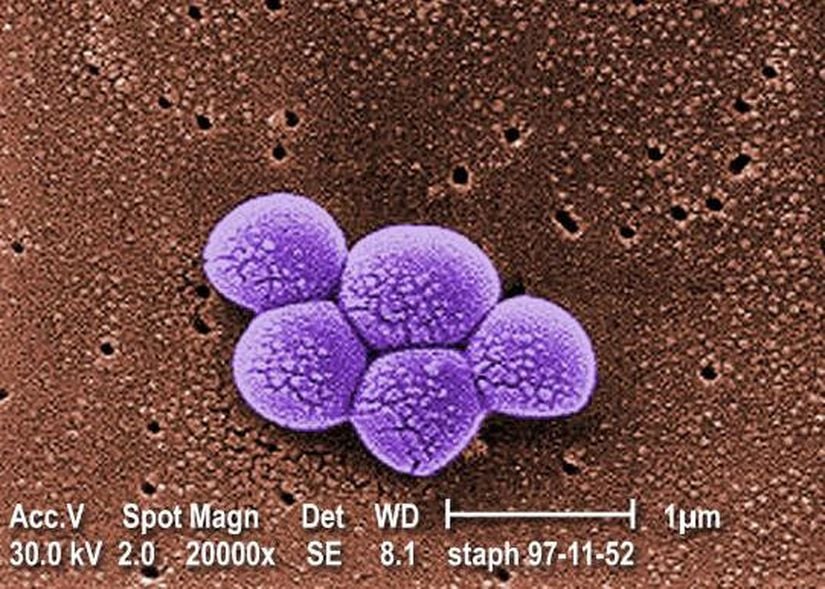 MRSA bakterisi