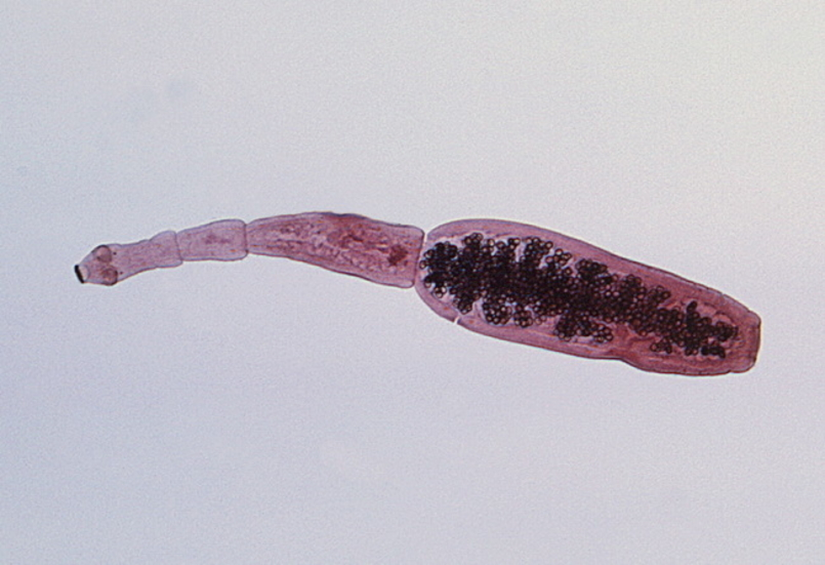 Ergin Echinococcus granulosus.