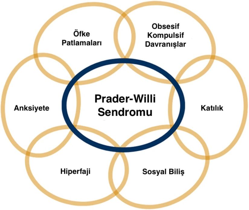 Prader-Willi Sendromu'nun birbiriyle ilişkili temel davranışsal özellikleri.