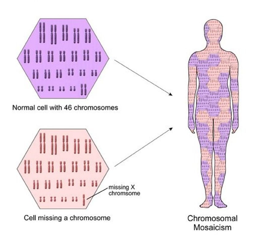 Kromozomal mozaiklik, yumurta ve sperm dışındaki hücrelerde hücre bölünmesindeki bir hatadan kaynaklanır. Mozaik Turner sendromu, kromozomal mozaikliğin bir örneğidir.