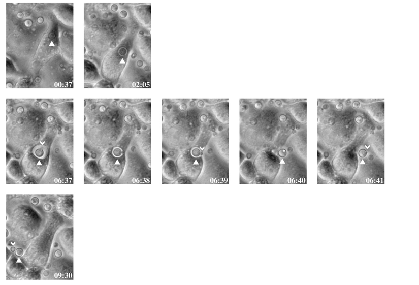 Şekil 2. Mantar hücrelerinin makrofaj dışına salınması (Ma, 2006).