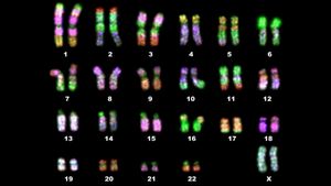 Karyotip Nedir? Karyotip Analizi, Gebelik Sırasında Kusurlu Kromozomların Tespitini Nasıl Sağlar?