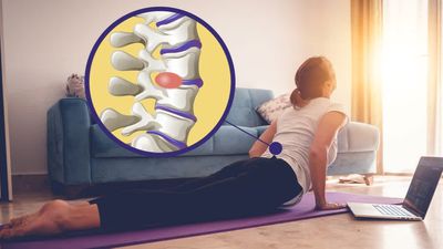 Bel Fıtığı Nedir? Spinal Disk Hernisi Neden Oluşur ve Nasıl Tedavi Edilir?