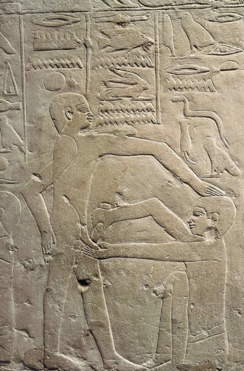 Altıncı Hanedanlığa ait Mısırlı bir mezartaşı çiziminde, sünnet uygulaması görülüyor.