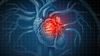 Kalp Krizi Nedir? Kalp Krizini Önlemek Mümkün mü? Kalp Krizi Geçirenlerin Tedavisinde Kullanılan Yöntemler Nelerdir?