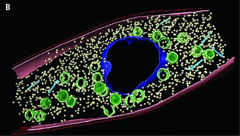 CET datasının renklendirilmiş hali. Ortadaki mavi yapı virüsün DNA'sını içeren kompartıman. Yeşil daireler capsid proteinleri, küçük sarı noktalar ise bakterinin ribozomları. Bazı capsid proteinlerinin açık mavi renkte kuyrukları mevcut.