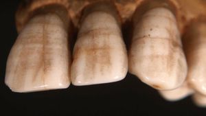 Tarihöncesi İnsan Dişleri, Gerçek 