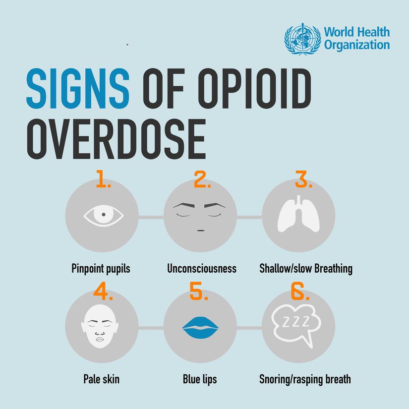 Opioid Aşırı Doz Belirtileri  (Soldan sağa) Toplu iğne başı gözbebekleri, Bilinç kaybı, Sığ/Yavaş nefes alma, Soluk ten rengi, Morarmış dudaklar, Horlama/Hırıltılı nefes