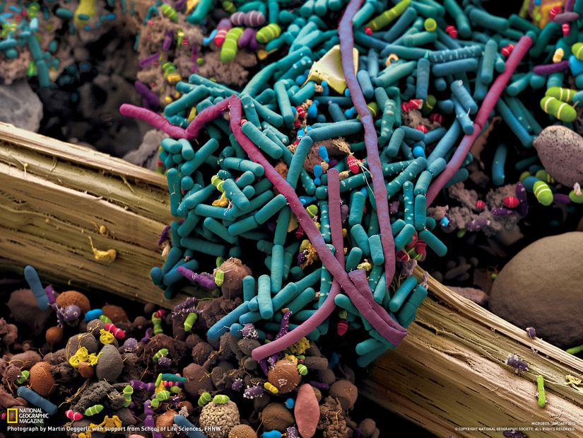 Elektron mikroskobu altında çekilmiş bakteri fotoğraflarının renklendirilmiş hali