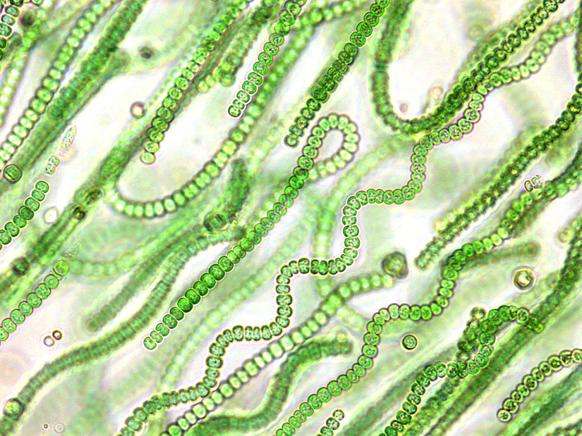 Bir siyanobakteri türünün mikroskop altındaki görüntüsü