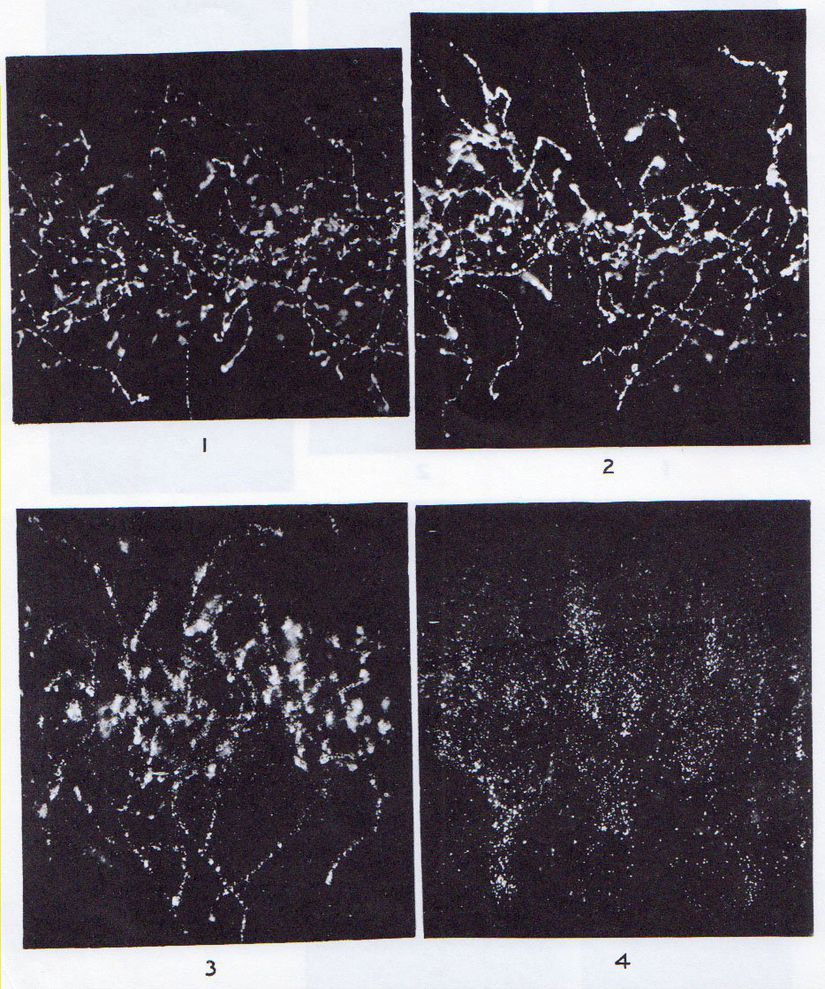 Wilson Sis Odası Deneyi: X-Işınlarının Gaz İçerisinde Arkalarında Bıraktıkları İzler / 1912