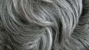 Marie Antoinette Sendromu: Saç Rengi, Strese veya Travmaya Bağlı Olarak Bir Gecede Beyazlaşabilir mi?
