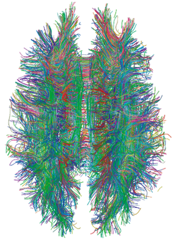 İnsan beynindeki sinir ağ ve yolakları