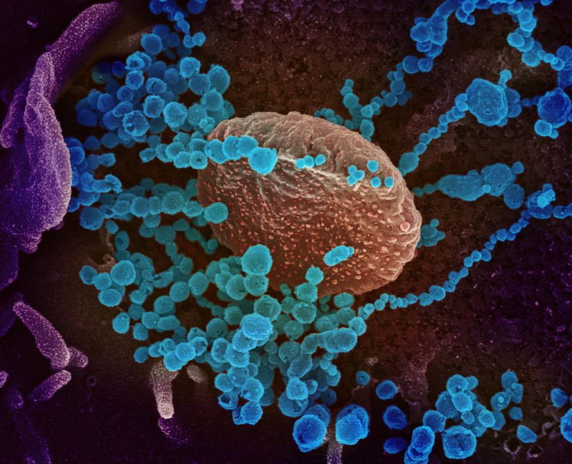 Enfekte olmuş bir hastadan izole edilen SARS-CoV-2 virüsünün laboratuvarda kültüre edilmiş hücrelerin yüzeyinden ortaya çıkışı
