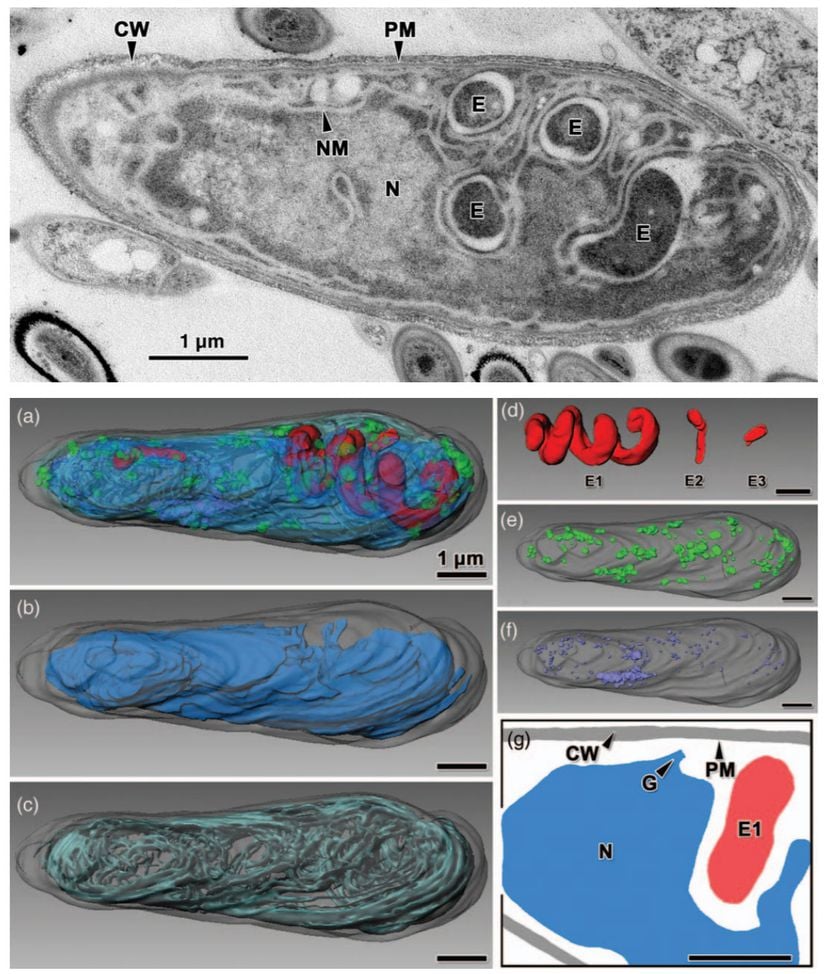 Üstte, Parakaryon myojinensis türünün ultra-ince bir kesidi gözüküyor. Tek nükleoit zara (NM) sahip düzensiz nükleoitine (N), endosimbiyontların (E) varlığına ve mitokondrinin noksanlığına dikkat ediniz. Ayrıca hücre duvarı (CW) ve plazma zarı (PM) da bulunmaktadır. Alt tarafta ise hücrenin üç boyutlu rekonstrüksiyonu görülmektedir.