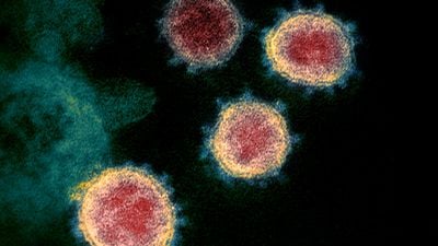 Ağır COVID-19 Vakalarında, Lupus Benzeri Bir Bağışıklık Yanıtı Görülüyor!