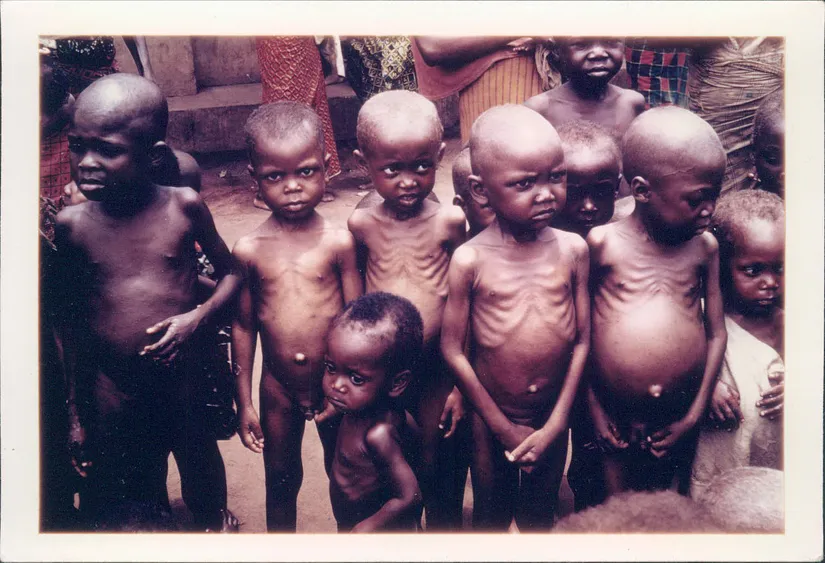 Açlıktan ölen çocuklar, kötülük problemi için yaygın kullanılan bir örnektir.