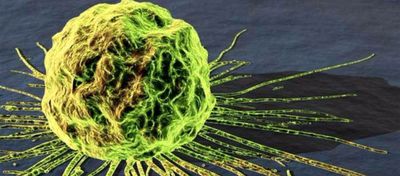 Nanoparçacıklar Kanser Hücrelerini Öldürebilir ve Yayılımını Durdurabilir!