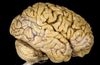 Sinirbilim ve Beyin - 11: İnsan'ı ''İnsan'' Yapan Yegane Yapı - Serebrum ve Genel Özellikleri