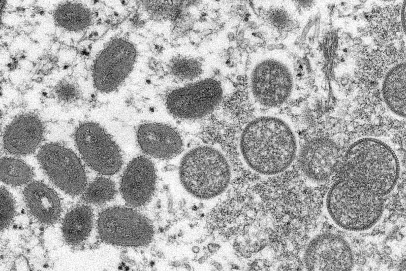 Elektron mikroskobu altındaki maymun çiçeği virüsleri