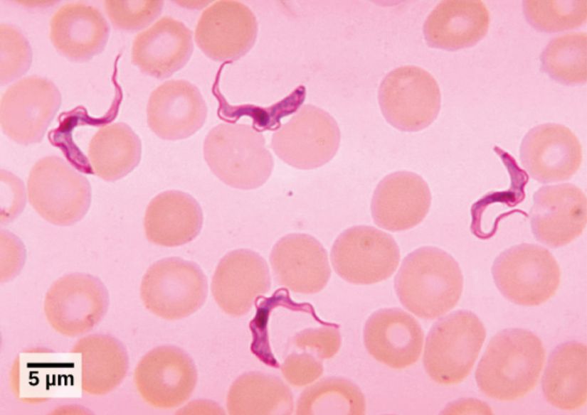 Bu ışık mikrografında kırmızı kan hücreleri arasında tripanosomlar görülebilmektedir.