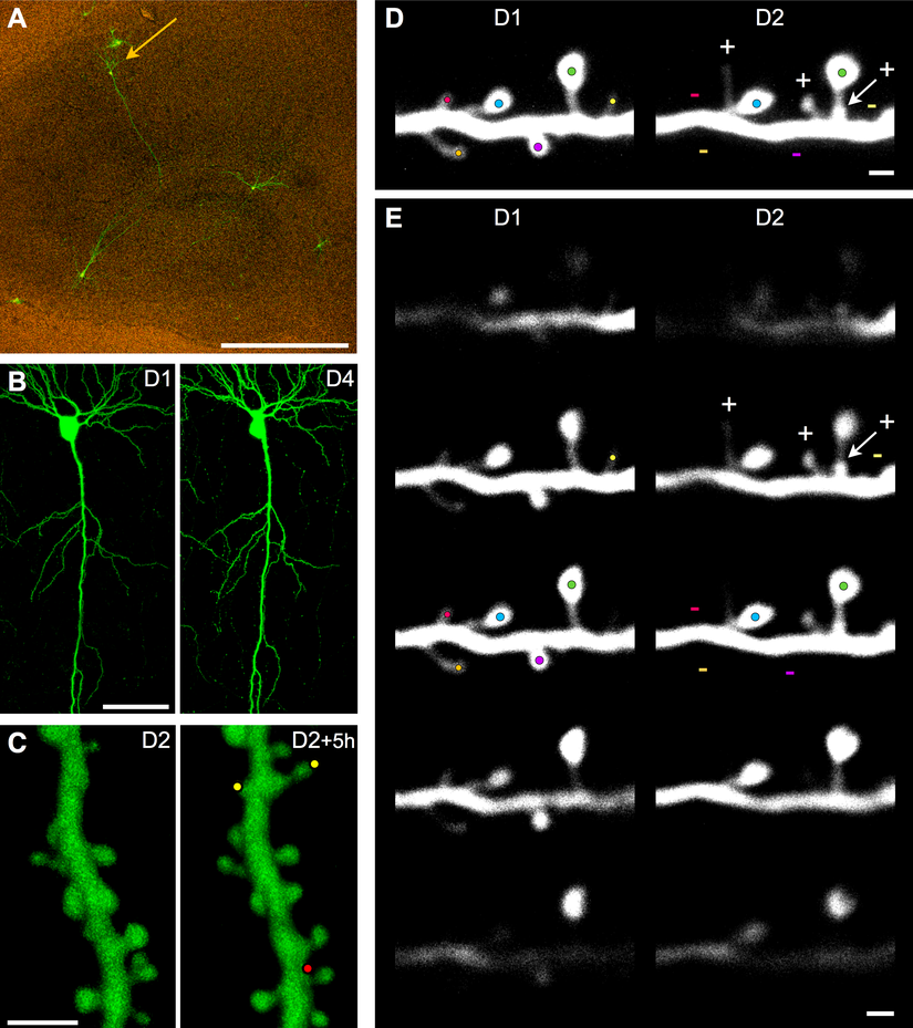 Memeli Beyninde Dendritik Spine Görüntüleri. Eksitatör sinapsların büyük kısmı bu ufak membranöz çıkıntılarda oluşur ve LTP indüklenmesi ile bir büyüme süreci gerçekleşir.