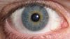 Güzel Bir Mutasyon: Heterokromi (Heterochromia)