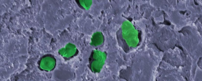 Boyanın içine yerleşmiş bakterilerin mikroskobik görüntüsü.