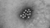 Hepatit A Nedir? Hepatovirüs A Nasıl Bir Hastalığa Sebep Olur?