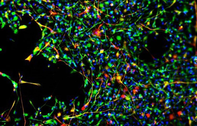 Nöral kök hücrelerinin astrositlere (sarı) farklılaşması