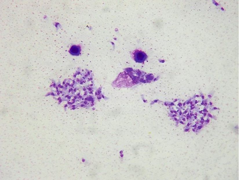 Toxoplasma gondii’nin ışık mikroskobu altındaki görüntüsü.