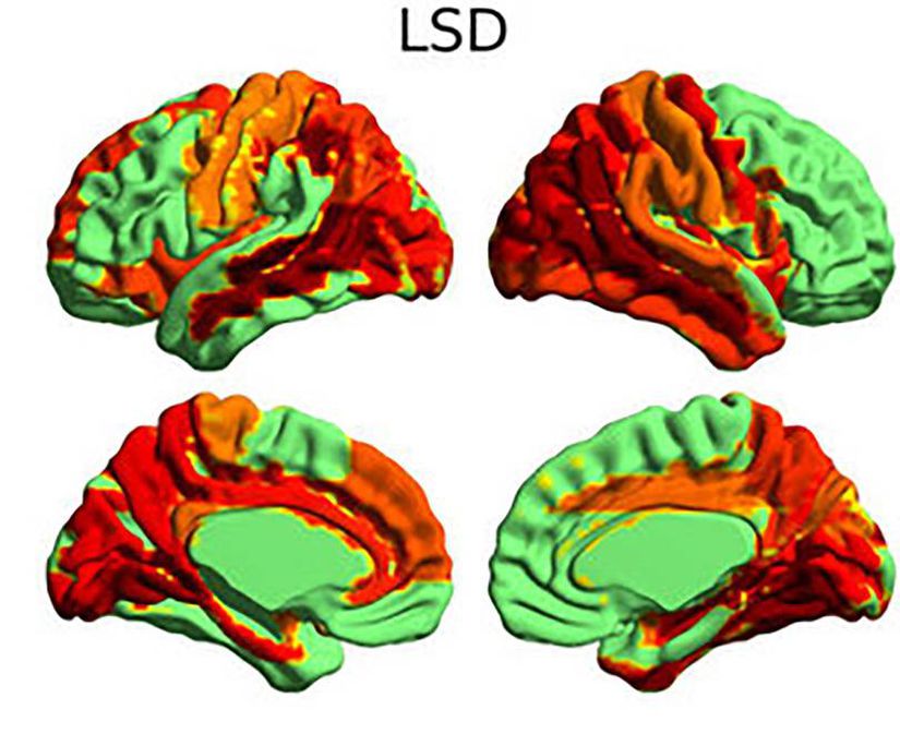 3 zihinsel manipülatörden biri olan LSD'nin beyne etkisi
