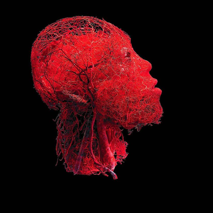 Görselde bir insanın boynundaki ve başındaki damarlar gözükmektedir.