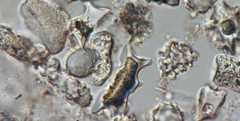 Mikroskop altındaki fitolitler. Bir fitolitin büyüklüğü sadece 10 mikrometre.