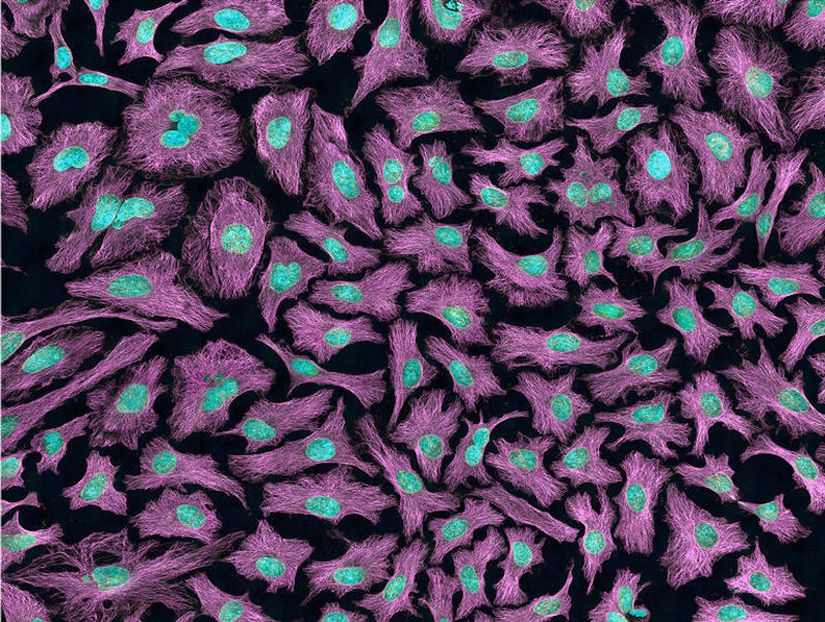 HeLa hücrelerinin floresan mikroskop görüntüsü: Hücre iskeleti mikrotübülleri (galibarda) ve DNA (açık mavi) görülüyor.