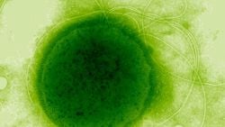 Radyasyona En Dayanıklı Canlı: Thermococcus gammatolerans