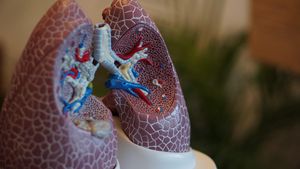 Could Glutamine Antagonists Be The Key To Tackling Resistant Lung Cancers?