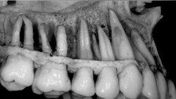 Dişlerimiz hakkında 5 ilginç gerçek