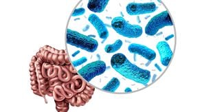 How Does Gut Microbiota Influence Obesity?