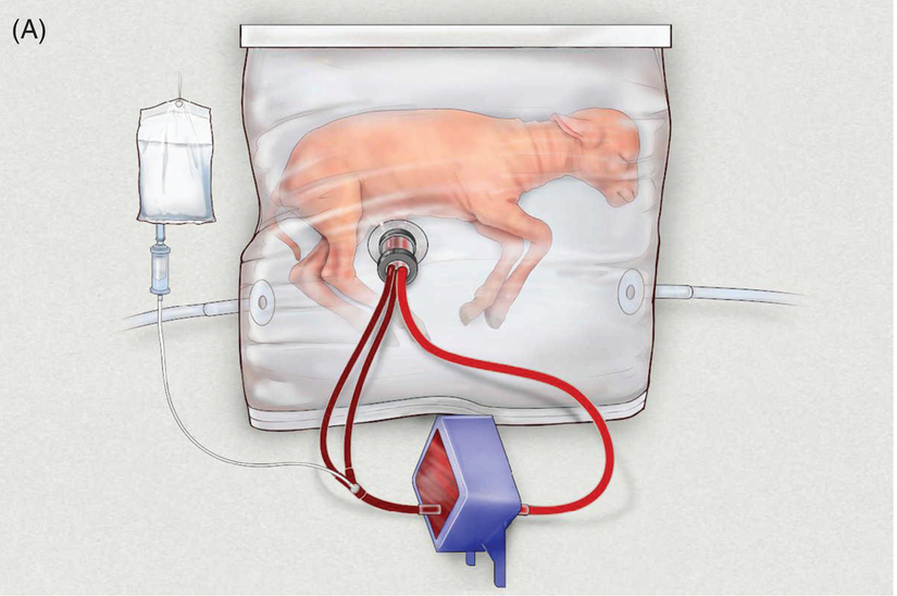 Bir kuzu fetüsü üzerindeki yapay rahim uygulamasının gösterimi.