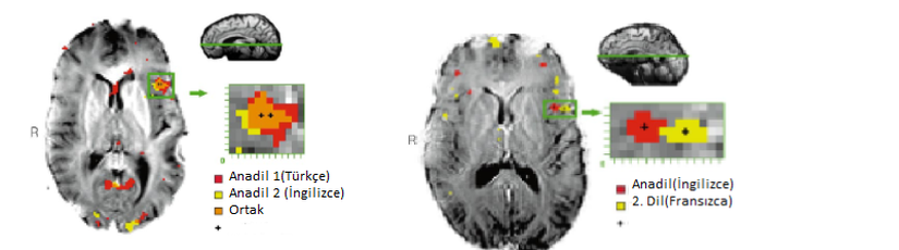 Çift Dilli Büyüyen İnsan Beyni vs. İkinci Dili Sonradan Edinen İnsan Beyni